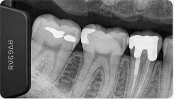 Digital X-ray machine